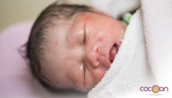 Newborn Infection Treatment in Jaipur